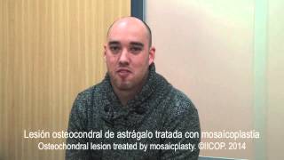 TESTIMONIO PACIENTE OPERADO DE OSTEOCONDRITIS DE ASTRAGALO [upl. by Esinwahs99]