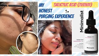 HONEST Review  Minimalist SALICYLIC ACID 2 Face Serum  Srishti Dubey [upl. by Witte25]