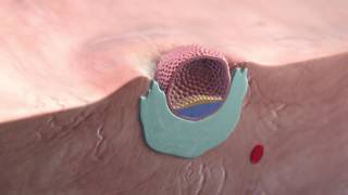 Implantation of the blastocyst [upl. by Sihun381]