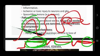 cerebral edema herniation hydrocephalus CVA and CNS infection [upl. by Isoais]