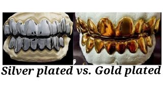 silver dipped grillz vs gold dipped Grillz [upl. by Leonidas165]