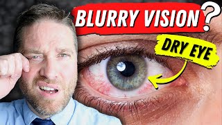 Why Dry Eyes Cause Blurry Vision  3 Reasons And 3 Home Remedies [upl. by Kipton183]