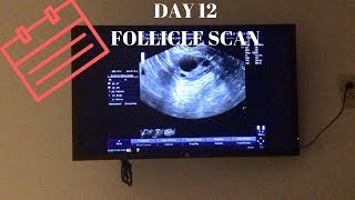 DAY 12 FOLLICLE SCAN [upl. by Monica]