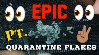 Thick amp Large Quarantine Flakes Part 2  Scratchers Anonymous ASMR Dandruff Flakes in Quarantine [upl. by Eibbor]