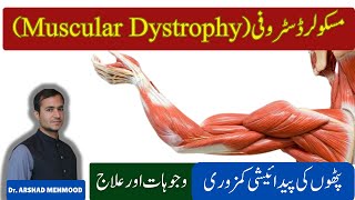 Duchenne Muscular Dystrophy DMD Symptoms Diagnosis Treatment amp Management  Muscular dystrophy [upl. by Anikal398]