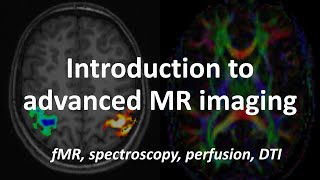 An Introduction to Advanced MRI techniques fMRI spectroscopy perfusion amp diffusion tensor imaging [upl. by Boccaj]