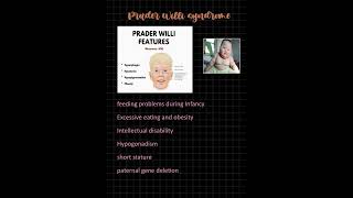 PRADER WILLI SYNDROME MNEMONIC fmge study MBBS [upl. by Libby]