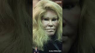 Jocelyn Wildenstein What happened after plastic surgery shorts [upl. by Vallonia]