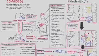 Liver Cirrhosis SandS Pathophysiology Investigations Management [upl. by Oidivo]