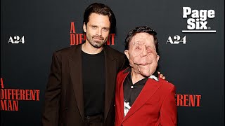 Sebastian Stan slams reporter for describing costar Adam Pearson as a ‘beast’ over disfigurement [upl. by Halimaj]