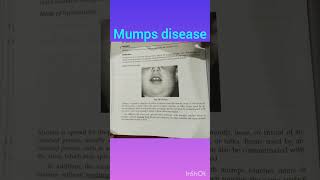 mumps disease shortvideo viraleducational nurshing PritYadavnf1tb [upl. by Kieryt]