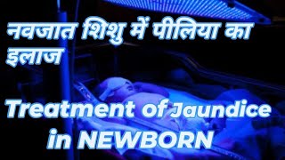 Newborn baby jaundice treatment in nicu  newbornbaby youtubeshorts babycare video nicunurse [upl. by Atiuqehc]