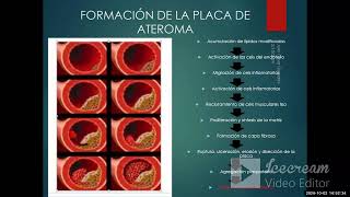 Cardiopatía isquémica I  AngioCardiología  sem 6 [upl. by Joappa935]