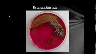 Bacteriology Gram Negative Bacilli Part1 [upl. by Retluoc69]