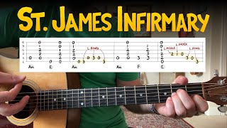 St James Infirmary — Acoustic Blues Guitar Lesson Key of A minor [upl. by Simmons64]