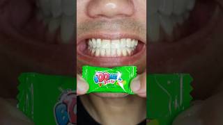 Super Sour Nobel Super Soda Candy ASMR 🤤🤩 [upl. by Reve]