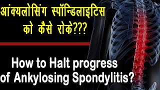 Ankylosing Spondylitis How to Halt Its progress II haltankylosingspondylitis [upl. by Marston]