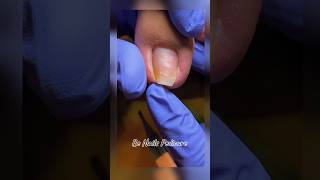 Nails satisfying pedicure shorts nails pedicure satisfying [upl. by Anisor]