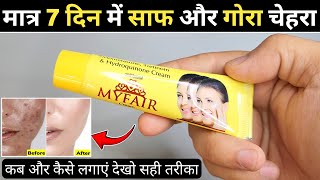 My Fair Cream Review 2024  my fair cream kaise use kare  myfair cream [upl. by Acemat]