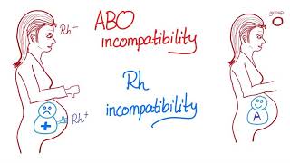 ABO incompatibility vs Rh incompatibility [upl. by Tyra434]