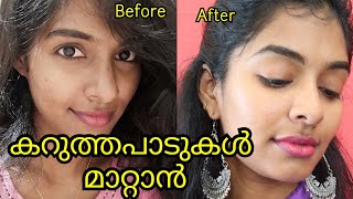 Vitamin C  Why How amp When To Use  Serum BenefitsStBotanica Serum REVIEWAsvi Malayalam [upl. by Ydnam]