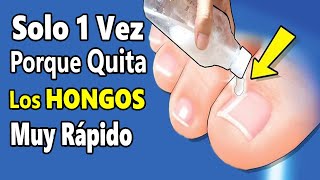 Echa este ACEITE 1 vez en tus PIES con HONGOS o BACTERIAS💅 Adiós HONGOS de las UÑAS en 2 días [upl. by Rusty]