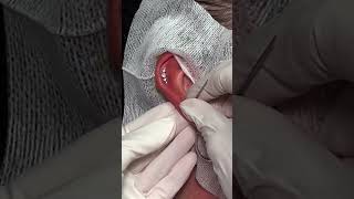 TRIGGER NEEDLE Wedding Inspired Ear Piercings using Base Laboratories Hypochlorous Acid Spay [upl. by Edahsalof]