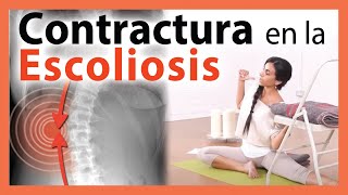 🛑 Dónde está la CONTRACTURA en la ESCOLIOSIS ▶ EJERCICIO para MEJORAR Yoga Terapéutico 😲 WOOOW [upl. by Carnes]