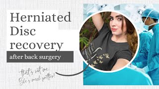 Herniated Disc surgery recovery story  Microdiscectomy recovery [upl. by Anomor]