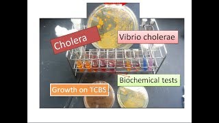 Cholera  Vibrio cholerae [upl. by Yzzo]