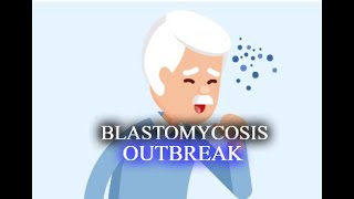 The Blastomycosis Outbreak [upl. by Grosvenor79]