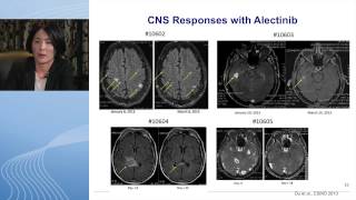 Segment 2 Molecular Targets in NSCLC [upl. by Lebiralc]