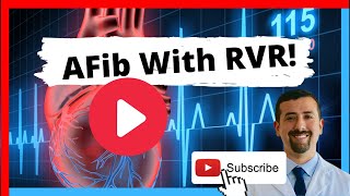 AFib with RVR Symptoms and Treatment [upl. by Maples]