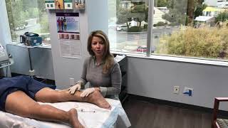 Live Sclerotherapy Treatment on the Leg with Dr Fabi [upl. by Sinnard552]