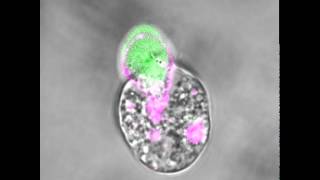 An amoeba eating a human cell [upl. by Elaweda]