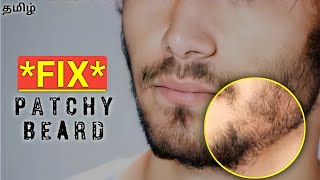 Simple Ways to Fix Patchy Beard  in தமிழ் [upl. by Dasteel]