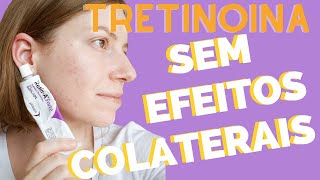 COMO COMEÇAR A USAR A TRETINOINA  Vitanol A Vitacid RetinA [upl. by Gone]