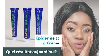 Mon avis sur épiderme 30g aujourdhui comment choisir sa crème de visage🙄🙄 [upl. by Beane]