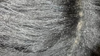 ITCHY DRY SCALP  FLAKY DANDRUFF  HAIR SCRATCHING ASMR [upl. by Ardelis]