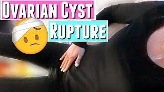 MY OVARIAN CYST RUPTURED  VLOGMAS Day 3 [upl. by Bilicki]