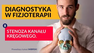 Stenoza kanału kręgowego Diagnostyka w fizjoterapii Odcinek 8 [upl. by Sarine]