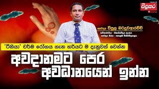 මොකක්ද මේ ටීනියා දිලීර රෝගය  අවදානමට පෙර අවධානයෙන් සිටින්න tinea virus vidusara [upl. by Delores]