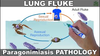 Paragonimiasis  Lung fluke and its Life Cycle [upl. by Hinda]