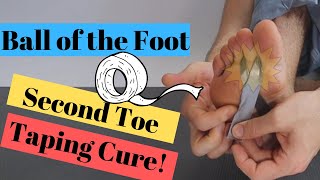 2nd Toe Pain Capsulitis amp Ball of Foot Taping BEST Home Treatment [upl. by Elylrac]