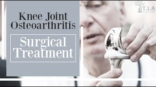 Knee Joint Osteoarthritis  Surgical treatment and postoperation recovery [upl. by Leanor112]