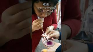 Physiology Practical WBC count neet2024 mbbsmotivation mbbs mbbslife mbbsstudent [upl. by Rudman]