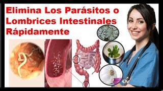 👉 Como Eliminar Los Parásitos o Lombrices Intestinales con Remedios Caseros 2021 🙂 ✅ [upl. by Shellie129]