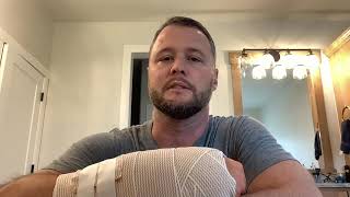 Scapholunate Ligament Tear  Reconstructive Surgery  day 1 recovery [upl. by Newmark467]