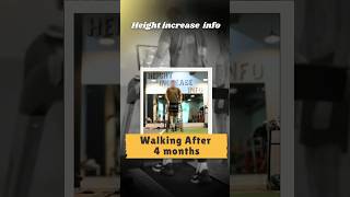 Walking after 4 months  Tibia lengthening patient  Achieved 52cm height heightincrease [upl. by Riggins]