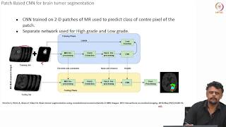 Segmentation of Brain Tumors from MRI using Deep Learning [upl. by Calvinna560]